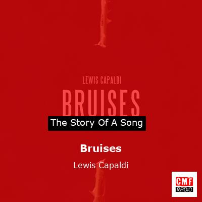 Bruises – Lewis Capaldi