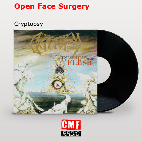 Open Face Surgery – Cryptopsy