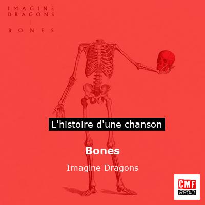 Bones – Imagine Dragons