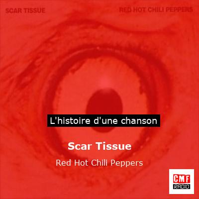 Scar Tissue – Red Hot Chili Peppers