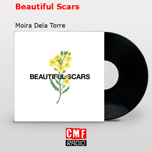 Beautiful Scars – Moira Dela Torre